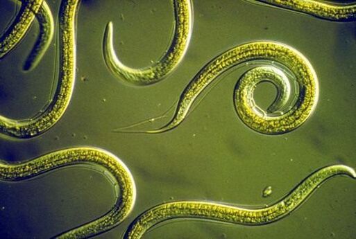 Vermes nematódeos parasitas no intestino delgado humano